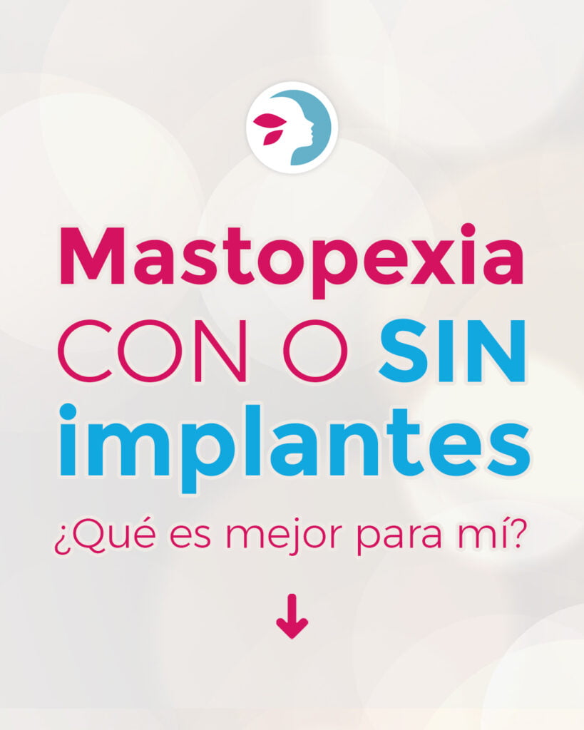 Mastopexia con implantes o sin implantes: ¿Qué debo elegir? mastopexia
