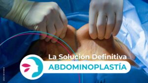 Transformación con la Abdominoplastía: