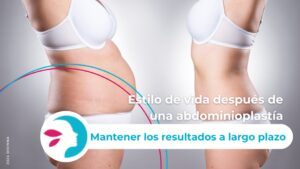 estilo de vida despues de abdominoplastia