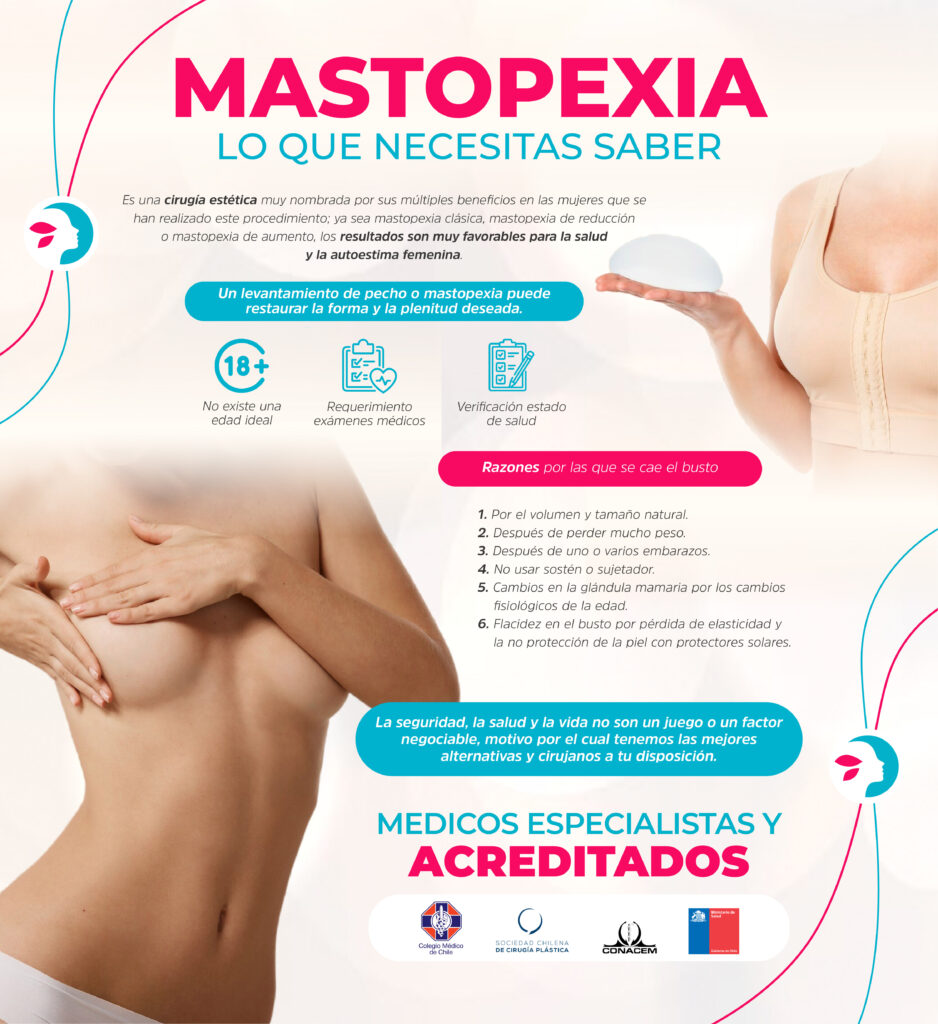 Mastopexia