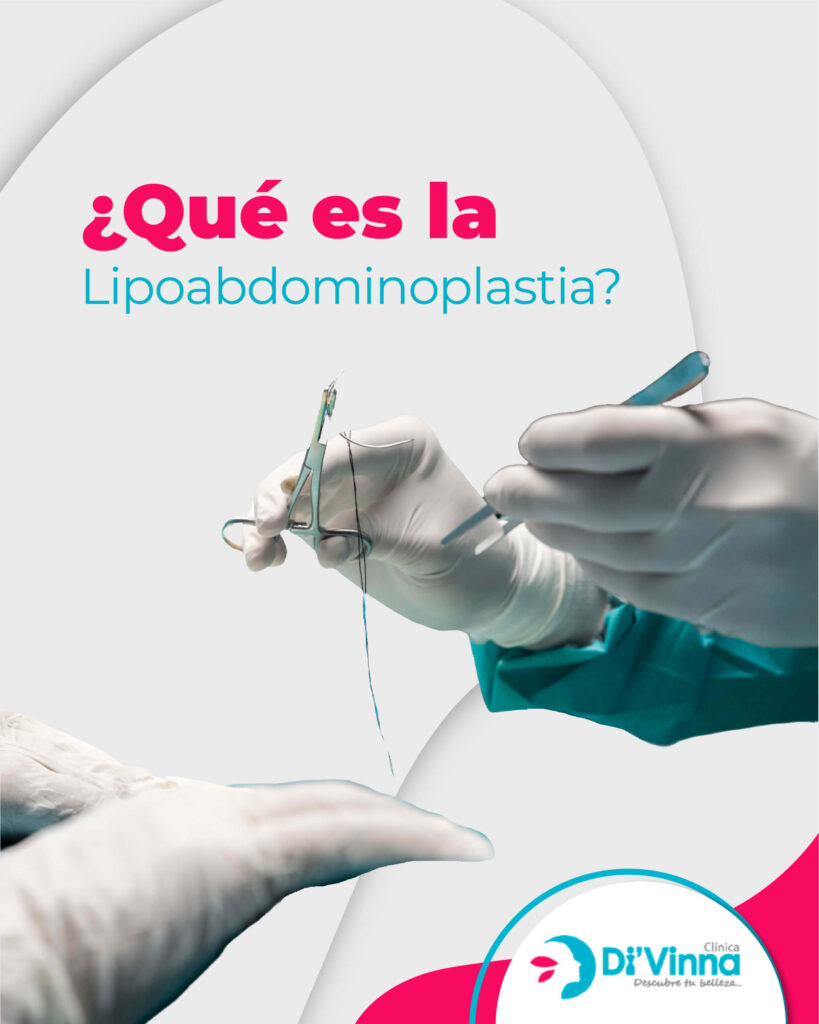 Lipoabdominoplastia