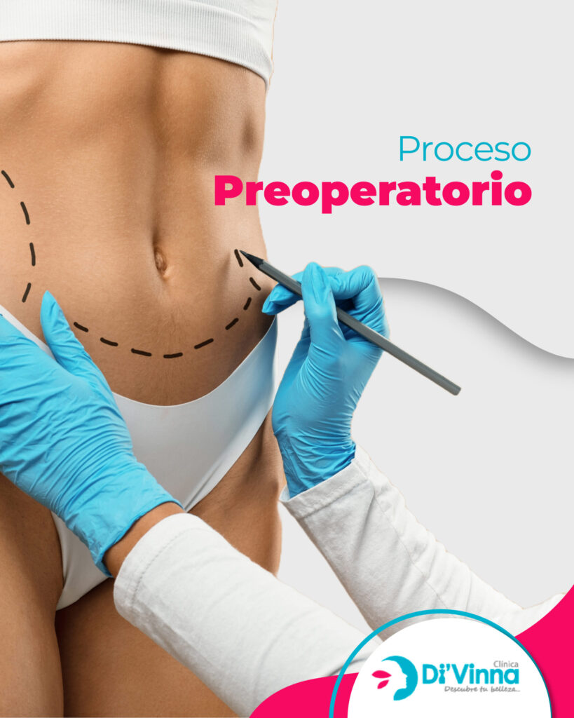 Equipo multidisciplinario en abdominoplastia Soporte en el Proceso Preoperatorio